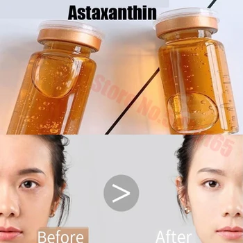 Naturale Soluție Stoc Esența Acid Hialuronic Hidratează Astaxantin Strălucire Anti-imbatranire de Îngrijire a Pielii Cosmetice coreene